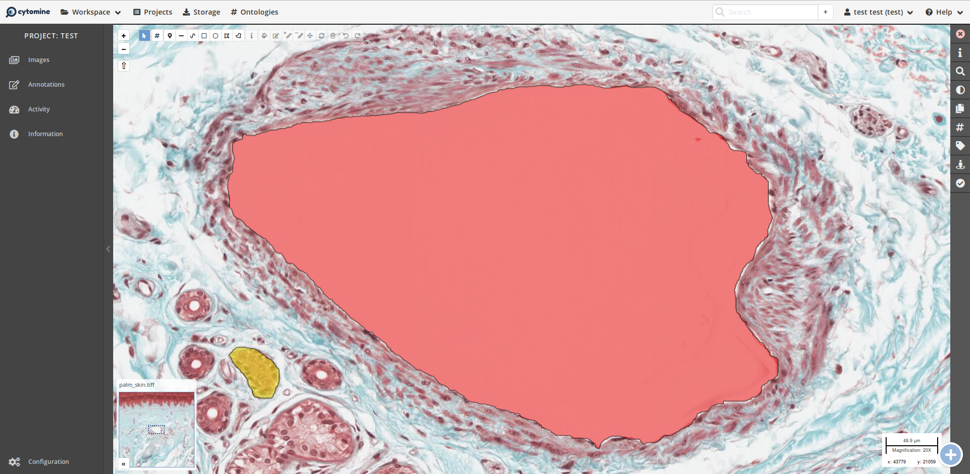 Annotation term in the viewer